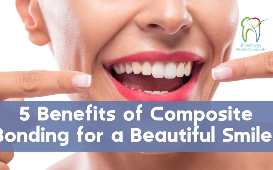 5 Benefits of Composite Bonding