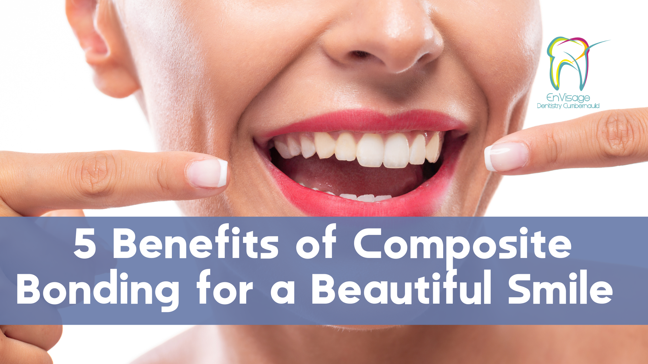 5 Benefits of Composite Bonding for a Beautiful Smile